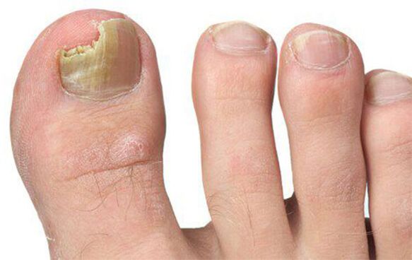 Different forms of fungi