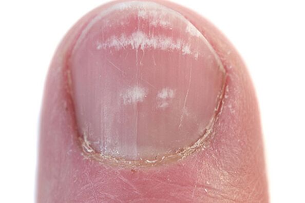 First signs and symptoms