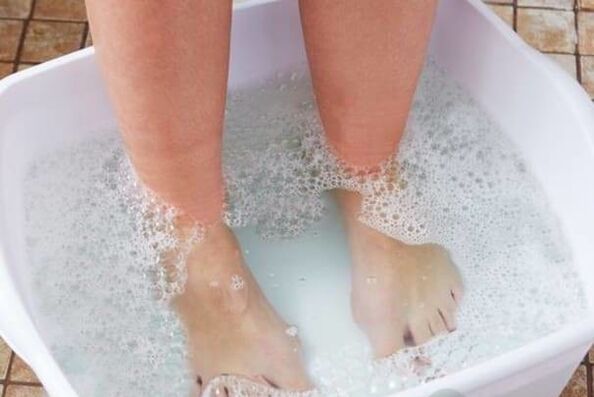 Treatment of nail fungi with popular remedies