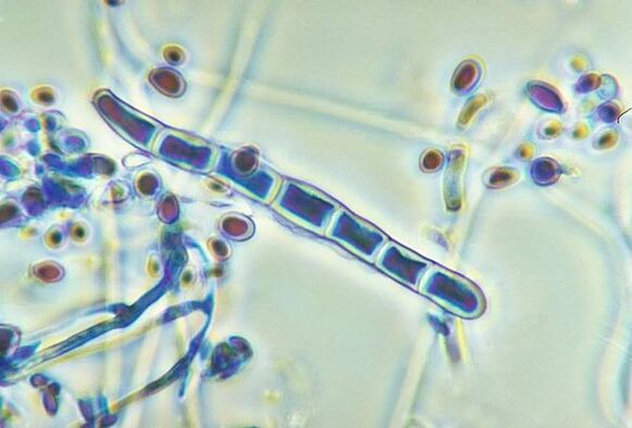 The fungus Trichophyton rubrum under a microscope